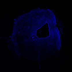 13PCW human midbrain